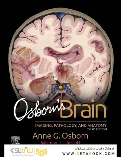 Osborn's Brain 3rd Edition
