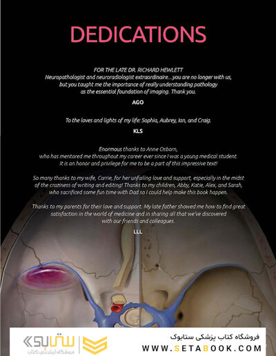 Osborn's Brain 3rd Edition