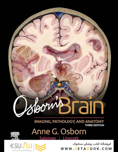 Osborn's Brain 3rd Edition