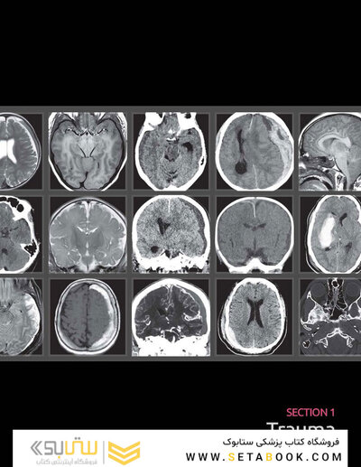 Osborn's Brain 3rd Edition