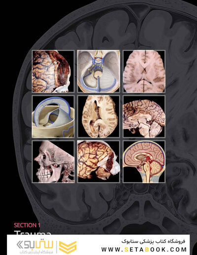 Osborn's Brain 3rd Edition