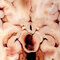 Osborn's Brain 3rd Edition