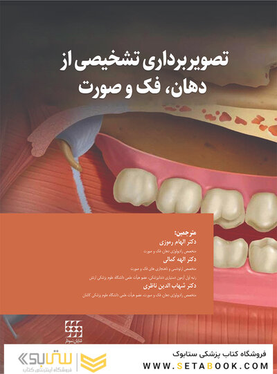 تصویربرداری تشخیصی از دهان، فک و صورت