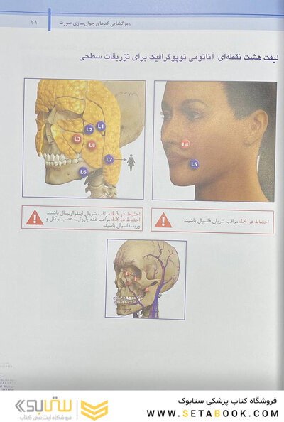 راهنمای گام به گام استفاده از ژل های تزریقی به روش MD-Codes – جلد دوم (رمزگشایی کد های جوان سازی صورت)