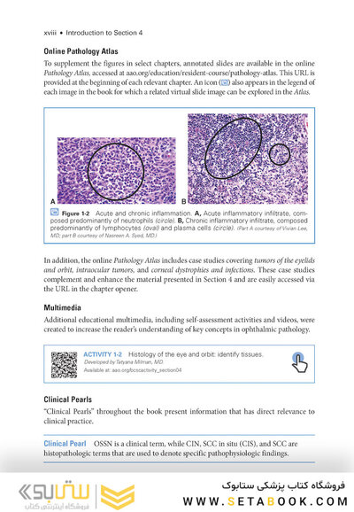 2024-2025 Basic and Clinical Science Course, Section 4: Ophthalmic Pathology and Intraocular Tumors