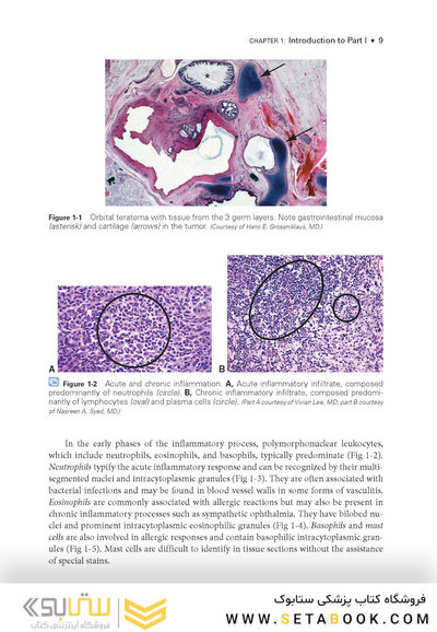 2024-2025 Basic and Clinical Science Course, Section 4: Ophthalmic Pathology and Intraocular Tumors