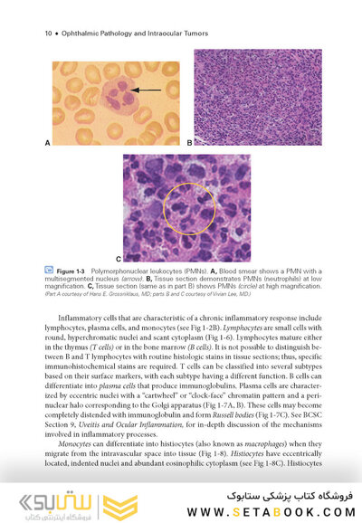 2024-2025 Basic and Clinical Science Course, Section 4: Ophthalmic Pathology and Intraocular Tumors