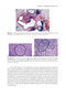 2024-2025 Basic and Clinical Science Course, Section 4: Ophthalmic Pathology and Intraocular Tumors
