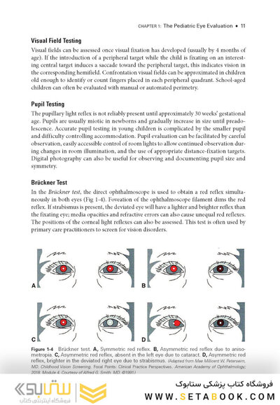 2024-2025 Basic and Clinical Science Course, Section 6: Pediatric Ophthalmology and Strabismus