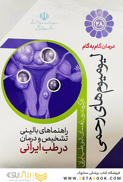 درمان گام به گام لیومیوم های رحمی