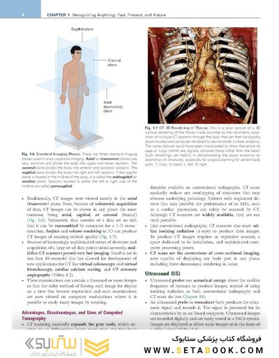 Learning Radiology Recognizing the Basics 5th Edition 2024
