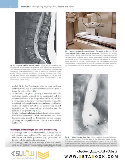 Learning Radiology Recognizing the Basics 5th Edition 2024
