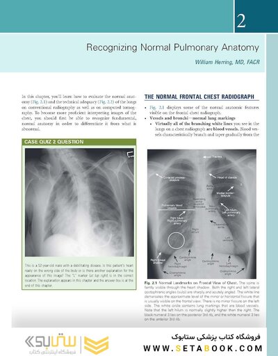 Learning Radiology Recognizing the Basics 5th Edition 2024