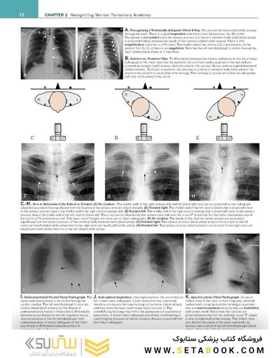 Learning Radiology Recognizing the Basics 5th Edition 2024