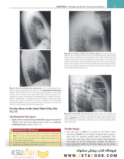 Learning Radiology Recognizing the Basics 5th Edition 2024