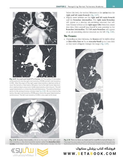 Learning Radiology Recognizing the Basics 5th Edition 2024