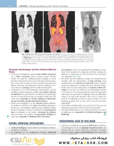 Learning Radiology Recognizing the Basics 5th Edition 2024