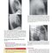 Learning Radiology Recognizing the Basics 5th Edition 2024