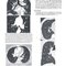 Learning Radiology Recognizing the Basics 5th Edition 2024