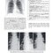 Learning Radiology Recognizing the Basics 5th Edition 2024