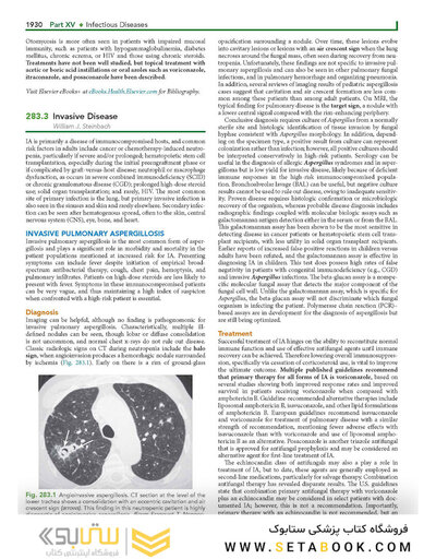 Nelson's Textbook of Pediatrics, Infectious Diseases (fungus, viruses and parasite), 22nd Edition