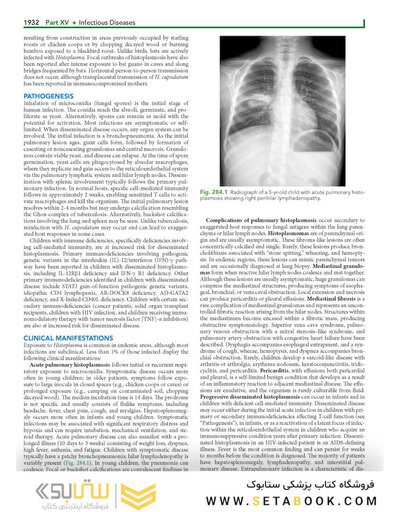 Nelson's Textbook of Pediatrics, Infectious Diseases (fungus, viruses and parasite), 22nd Edition