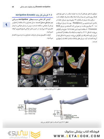 اصول جراحی دهان، فک و صورت پیترسون 2022 - جلد اول