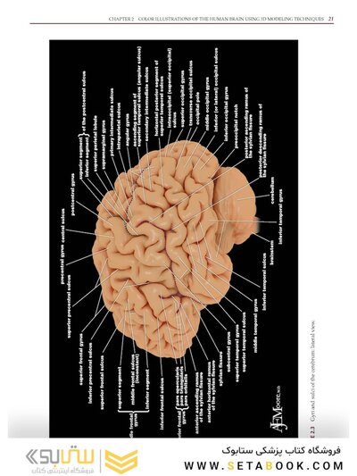 Imaging Anatomy of the Human Brain: A Comprehensive Atlas Including Adjacent Structures 1st Edition 2016