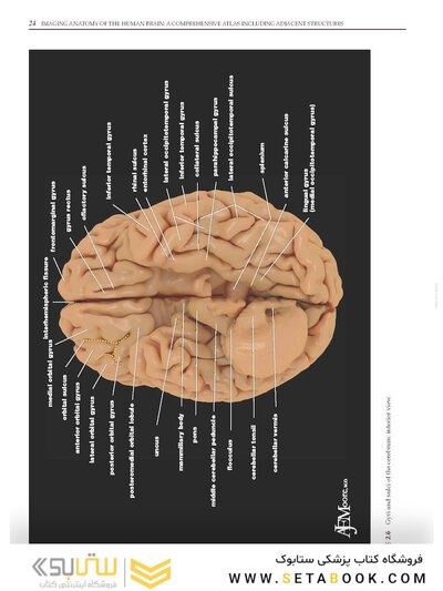 Imaging Anatomy of the Human Brain: A Comprehensive Atlas Including Adjacent Structures 1st Edition 2016