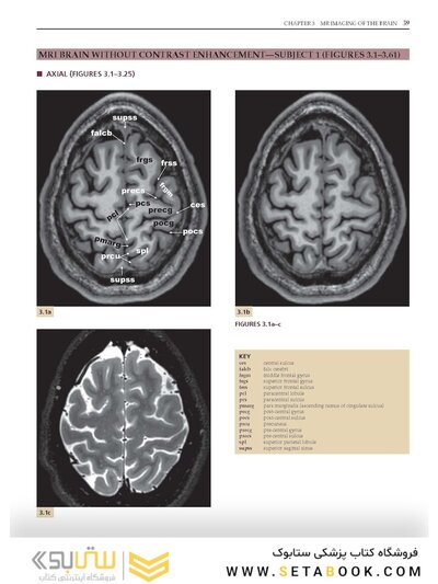 Imaging Anatomy of the Human Brain: A Comprehensive Atlas Including Adjacent Structures 1st Edition 2016