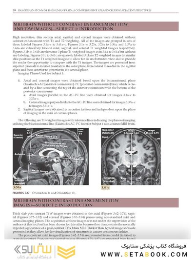 Imaging Anatomy of the Human Brain: A Comprehensive Atlas Including Adjacent Structures 1st Edition 2016