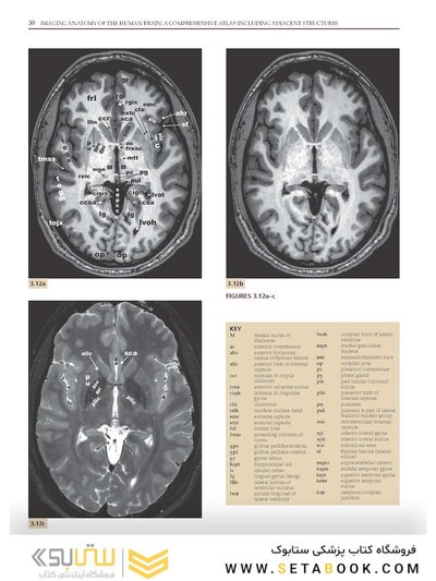 Imaging Anatomy of the Human Brain: A Comprehensive Atlas Including Adjacent Structures 1st Edition 2016