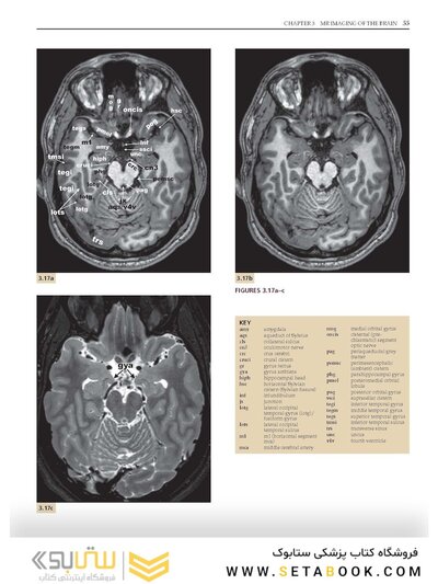 Imaging Anatomy of the Human Brain: A Comprehensive Atlas Including Adjacent Structures 1st Edition 2016