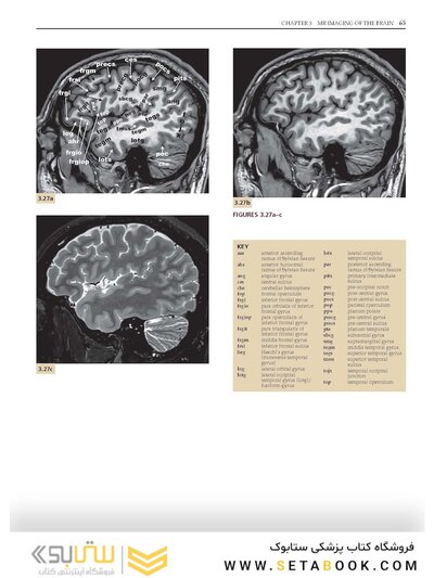 Imaging Anatomy of the Human Brain: A Comprehensive Atlas Including Adjacent Structures 1st Edition 2016