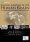 Imaging Anatomy of the Human Brain: A Comprehensive Atlas Including Adjacent Structures 1st Edition 2016