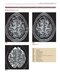 Imaging Anatomy of the Human Brain: A Comprehensive Atlas Including Adjacent Structures 1st Edition 2016