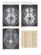 Imaging Anatomy of the Human Brain: A Comprehensive Atlas Including Adjacent Structures 1st Edition 2016
