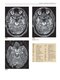 Imaging Anatomy of the Human Brain: A Comprehensive Atlas Including Adjacent Structures 1st Edition 2016