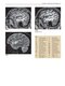 Imaging Anatomy of the Human Brain: A Comprehensive Atlas Including Adjacent Structures 1st Edition 2016