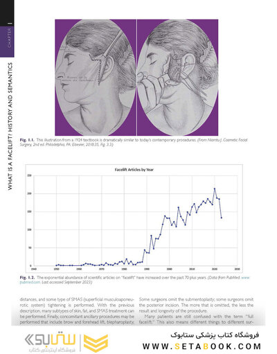 The Art and Science of Facelift Surgery 2nd Edition 2024