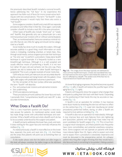 The Art and Science of Facelift Surgery 2nd Edition 2024