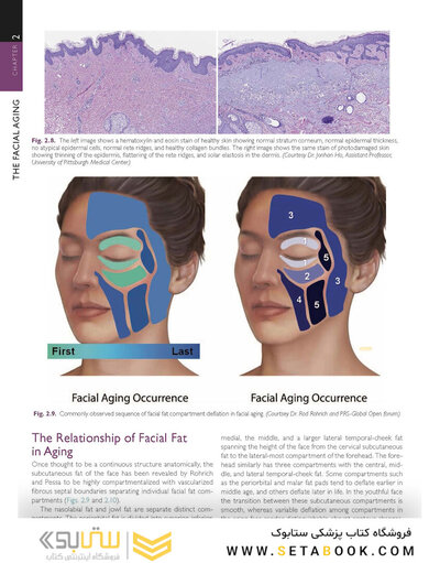The Art and Science of Facelift Surgery 2nd Edition 2024