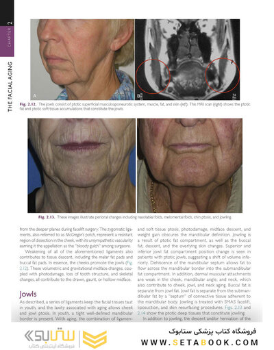 The Art and Science of Facelift Surgery 2nd Edition 2024