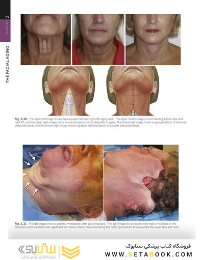 The Art and Science of Facelift Surgery 2nd Edition 2024
