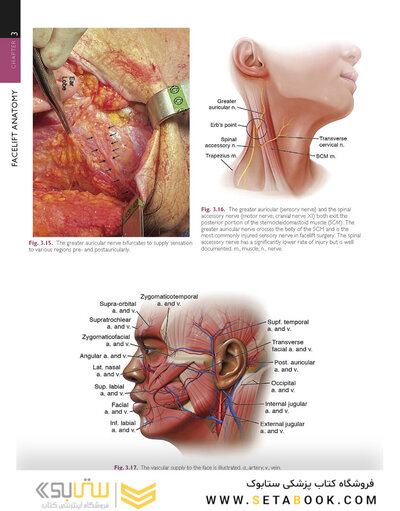 The Art and Science of Facelift Surgery 2nd Edition 2024