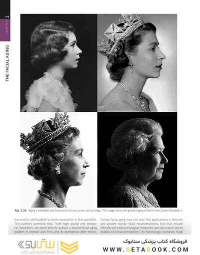The Art and Science of Facelift Surgery 2nd Edition 2024