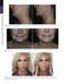 The Art and Science of Facelift Surgery 2nd Edition 2024