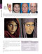 The Art and Science of Facelift Surgery 2nd Edition 2024