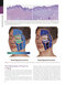 The Art and Science of Facelift Surgery 2nd Edition 2024