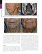 The Art and Science of Facelift Surgery 2nd Edition 2024